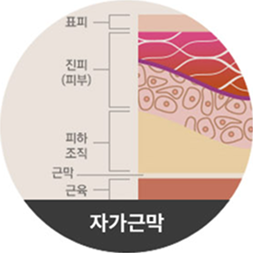자가근막