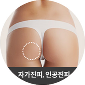 자가진피, 인공진피