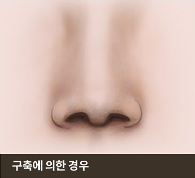 구축에 의한 경우