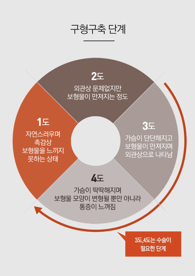 구형구축 1도부터 4도까지의 단계와 증상