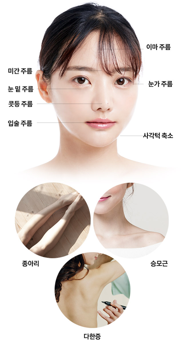 얼굴 주름과 윤곽 보톡스 시술 부위